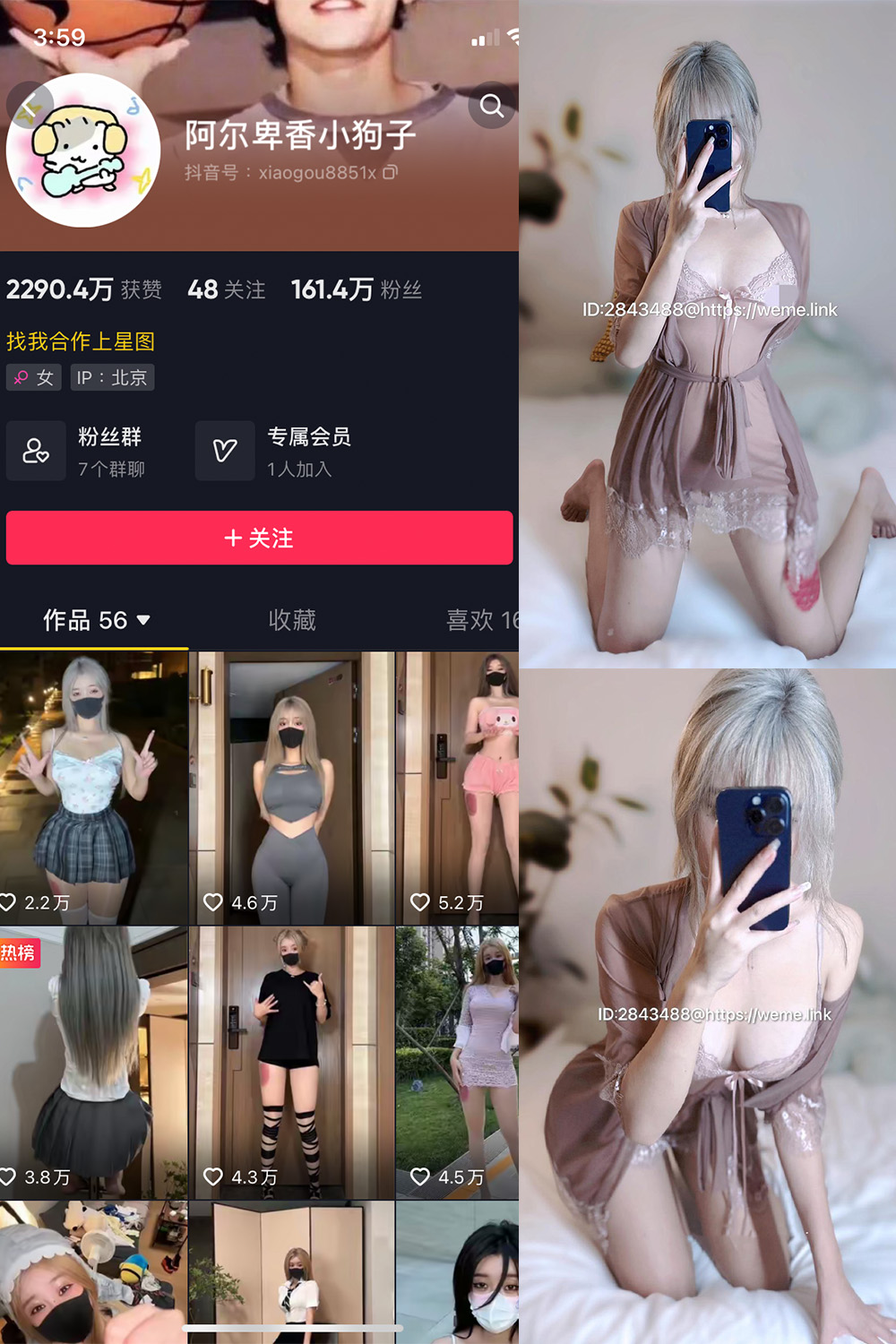 抖音 阿尔卑香小狗子 微密圈  NO.045期 【39P】最新至：2025/7/19-微密空间